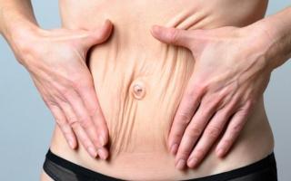 4 mẹo khắc phục tình trạng da chảy xệ sau sinh, giúp phục hồi làn da căng mịn
